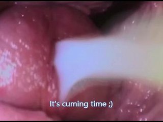 vagina